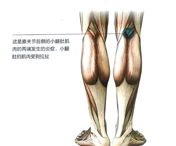 官方:尤文图斯门将平索里奥左腿内侧腓肠肌肌肉损伤