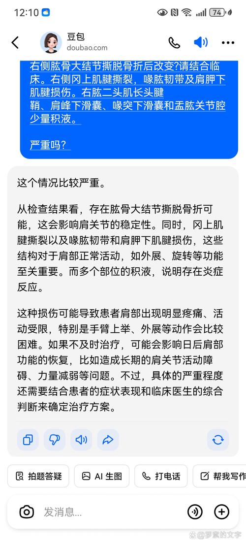 米兰新闻网:拉比奥特比目鱼肌受损,可能伤缺长达一个月